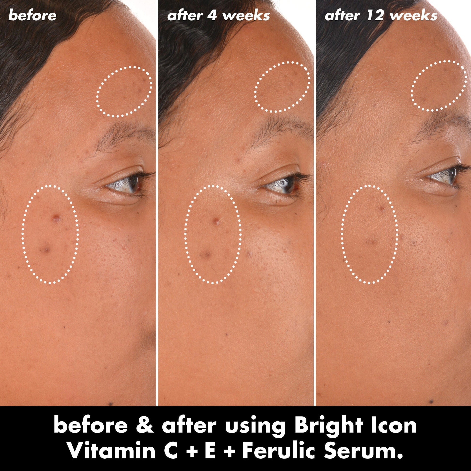 bright-icon-vitamin-c-e-ferulic-serum-b0 0226_EDU_BrightIconVitC_BA_Chanel_TRIPTYCH_c58f2fc8-209d-414f-9ba3-666a07a94887.jpg
