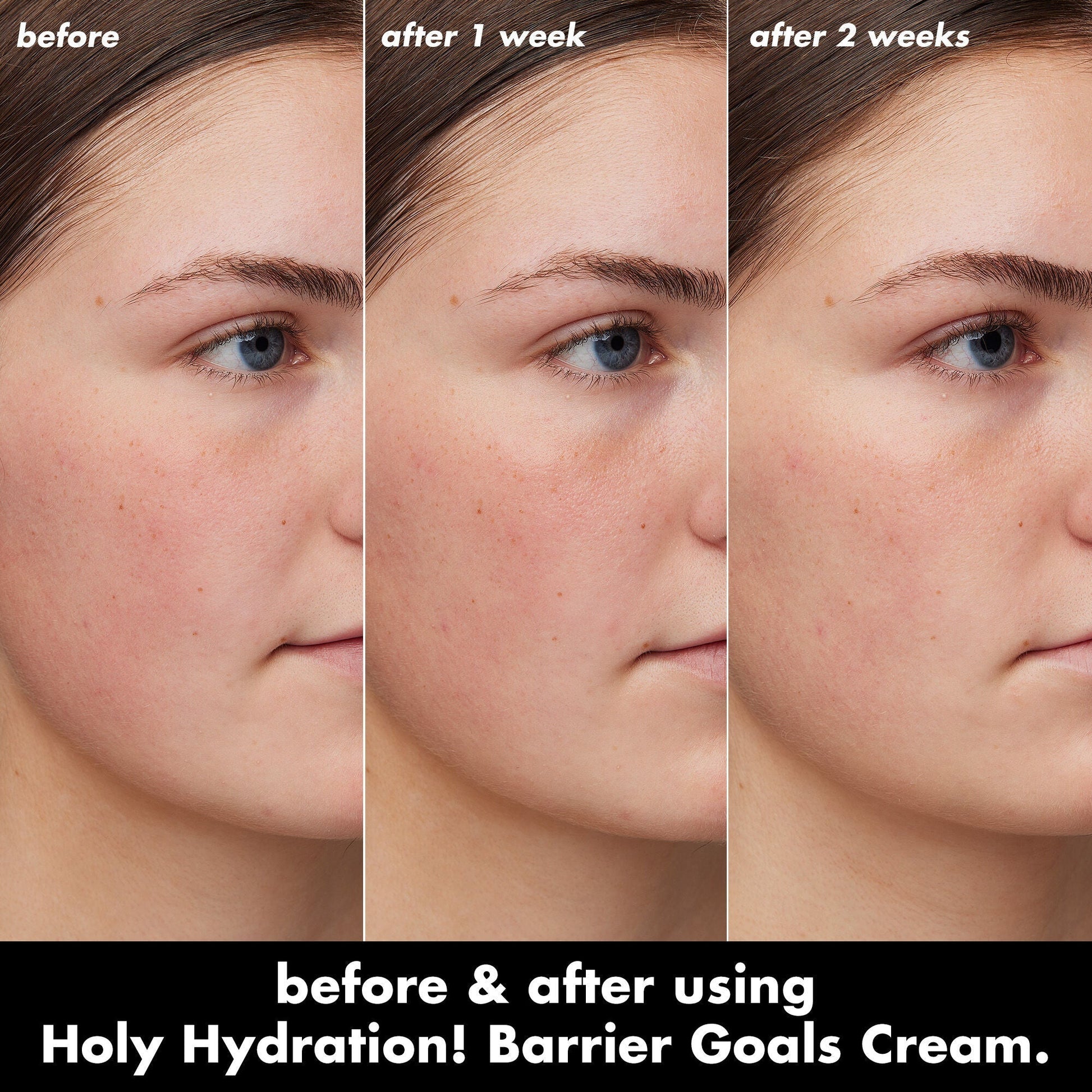 holy-hydration-barrier-goals-cream-mini-z5 0226_EDU_HHBarrierGoalsCream_B_A_Zoe_TRYPTICH_4f0e5b5d-35fb-4020-968e-244d4536afbd.jpg
