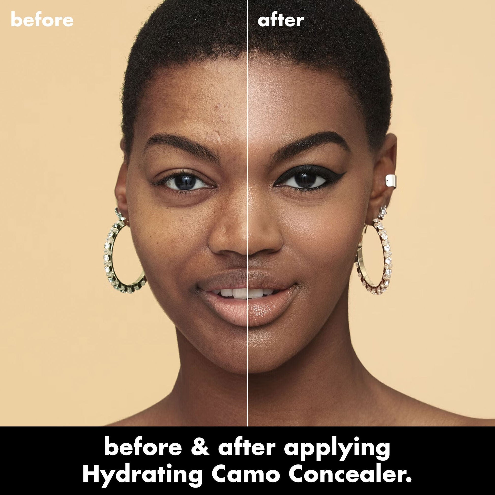 hydrating-camo-concealer-o0 0226_EDU_HydratingCamoConcelaer_BA_AshleyKaresh_20_1_d8499bbf-0e91-4173-b5e2-75127caf83a3.jpg