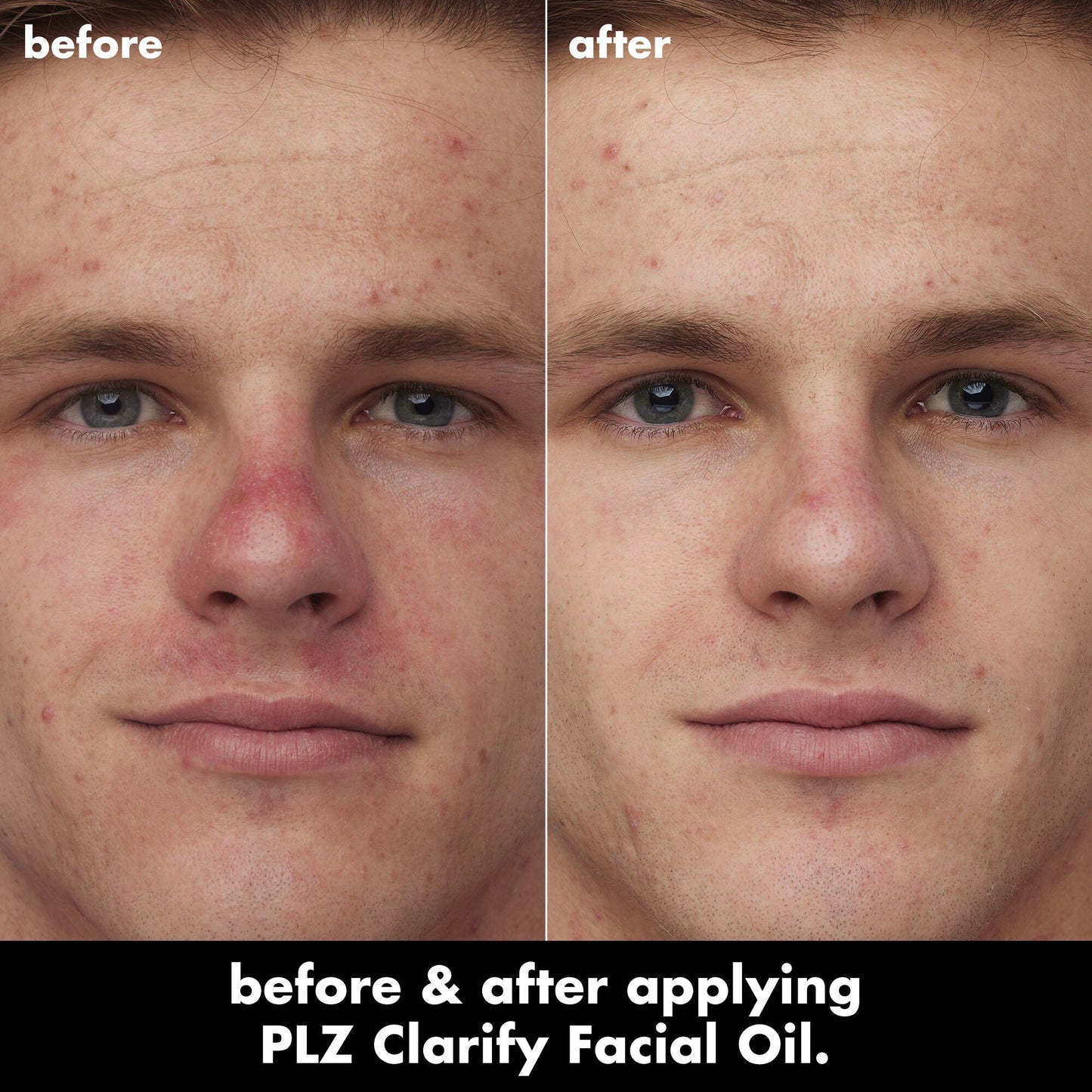 plz-clarify-facial-oil-x2 0326_EDU_PlzClarify_BA_Caleb.jpg
