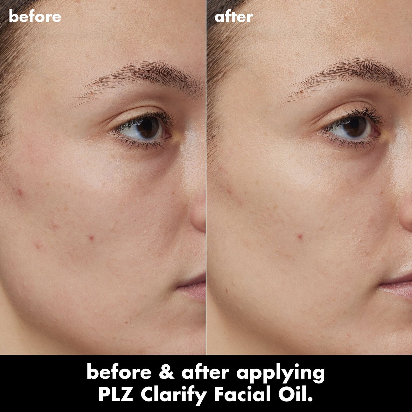 plz-clarify-facial-oil-x2 0326_EDU_PlzClarify_BA_Kelly.jpg