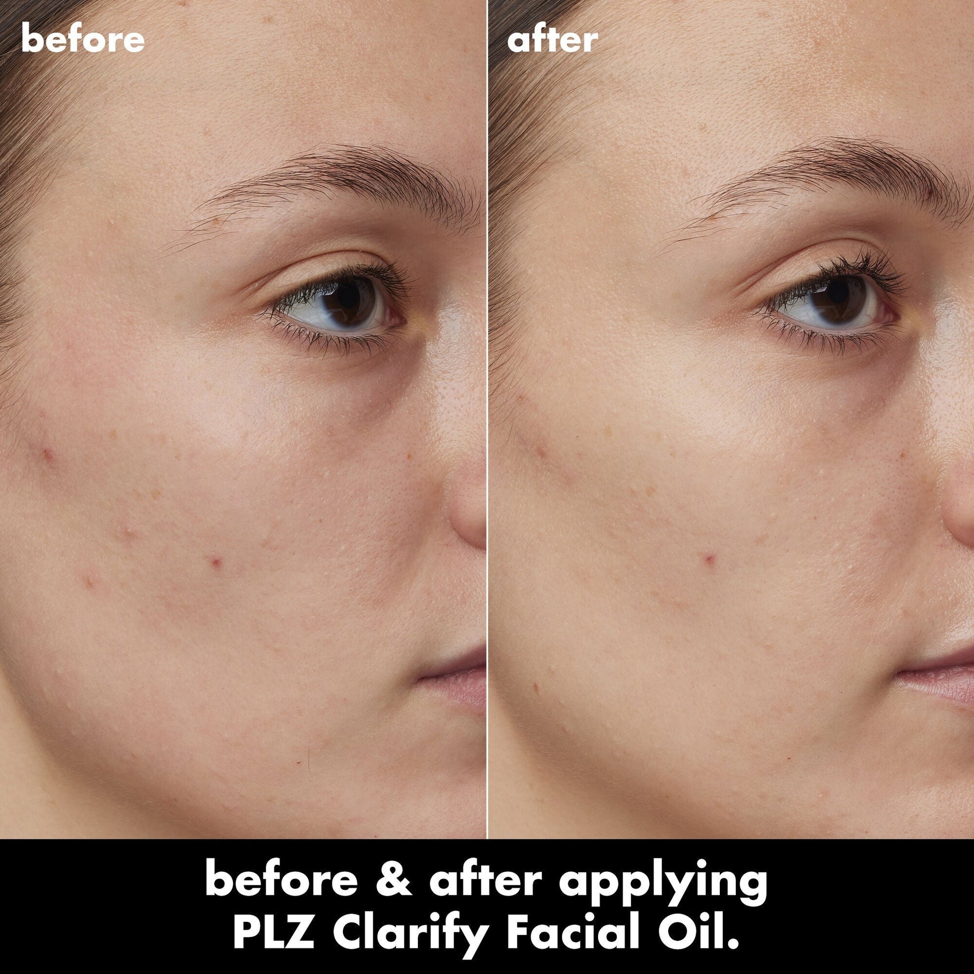 plz-clarify-facial-oil-x2 0326_EDU_PlzClarify_BA_Kelly.jpg