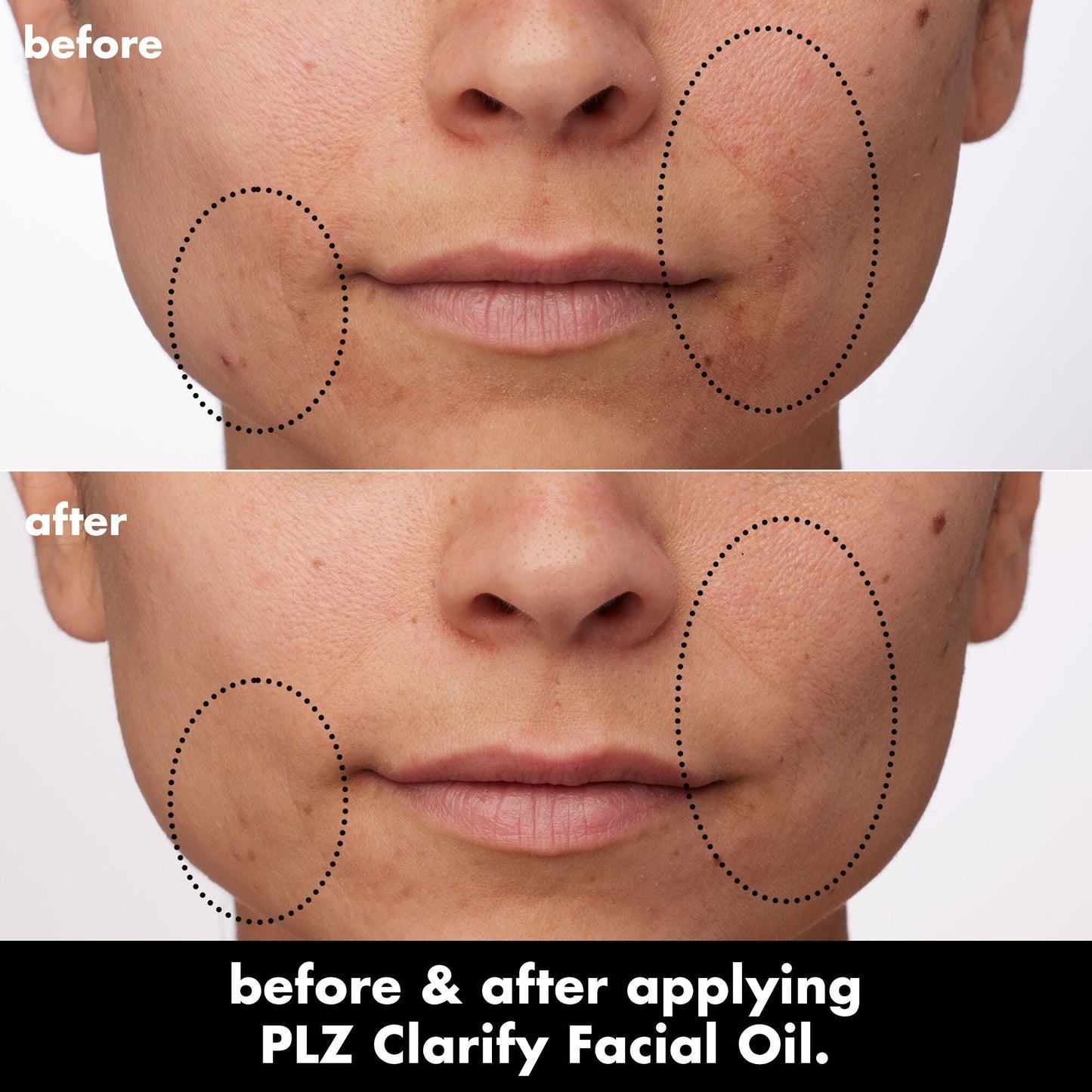 plz-clarify-facial-oil-x2 0326_EDU_PlzClarify_BA_Paula.jpg