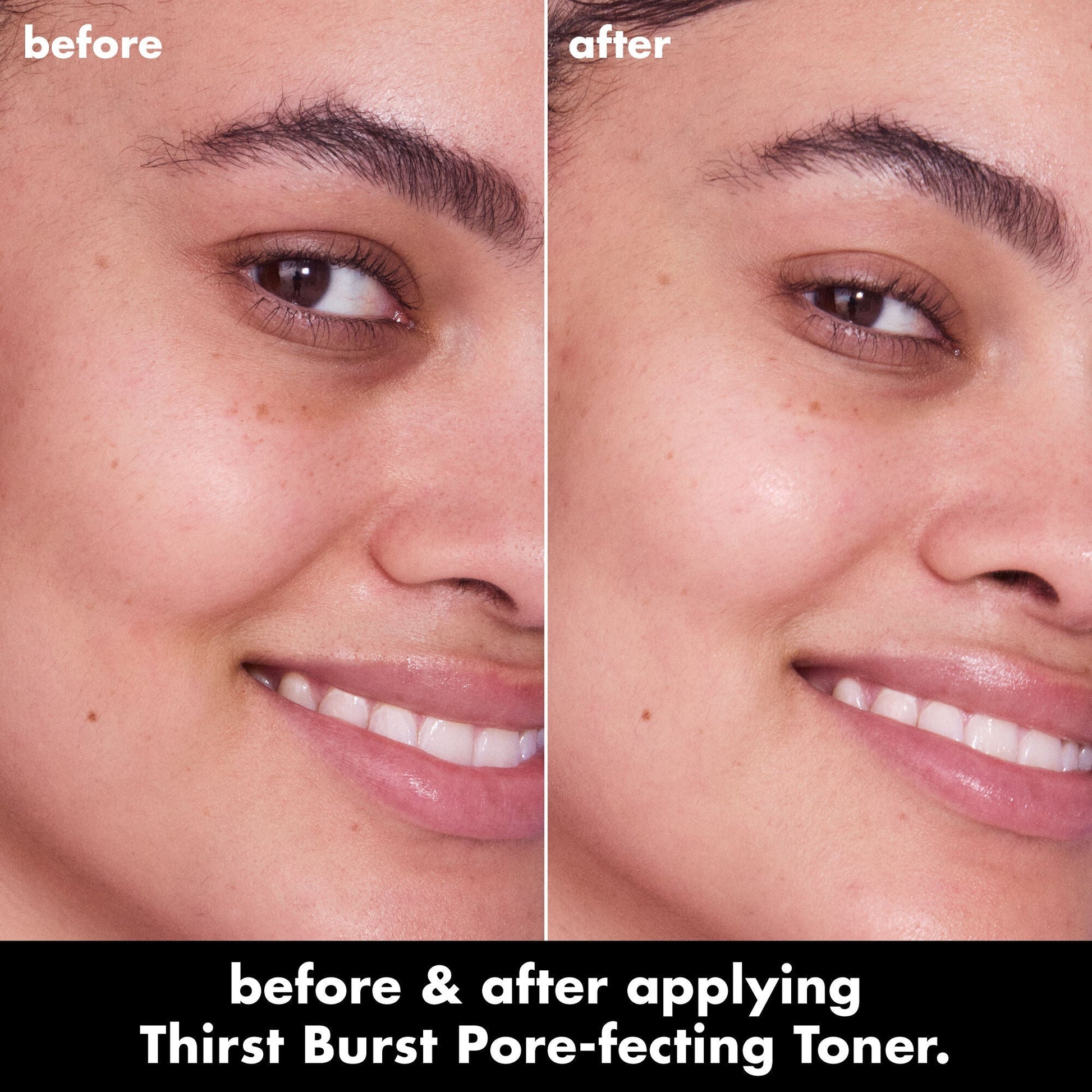 thirst-burst-pore-fecting-toner-o7 0326_EDU_THIRSTBURSTTONER_BA_Jade_5b0aaf31-8b58-4921-9f66-71e6ca0b8f83.jpg