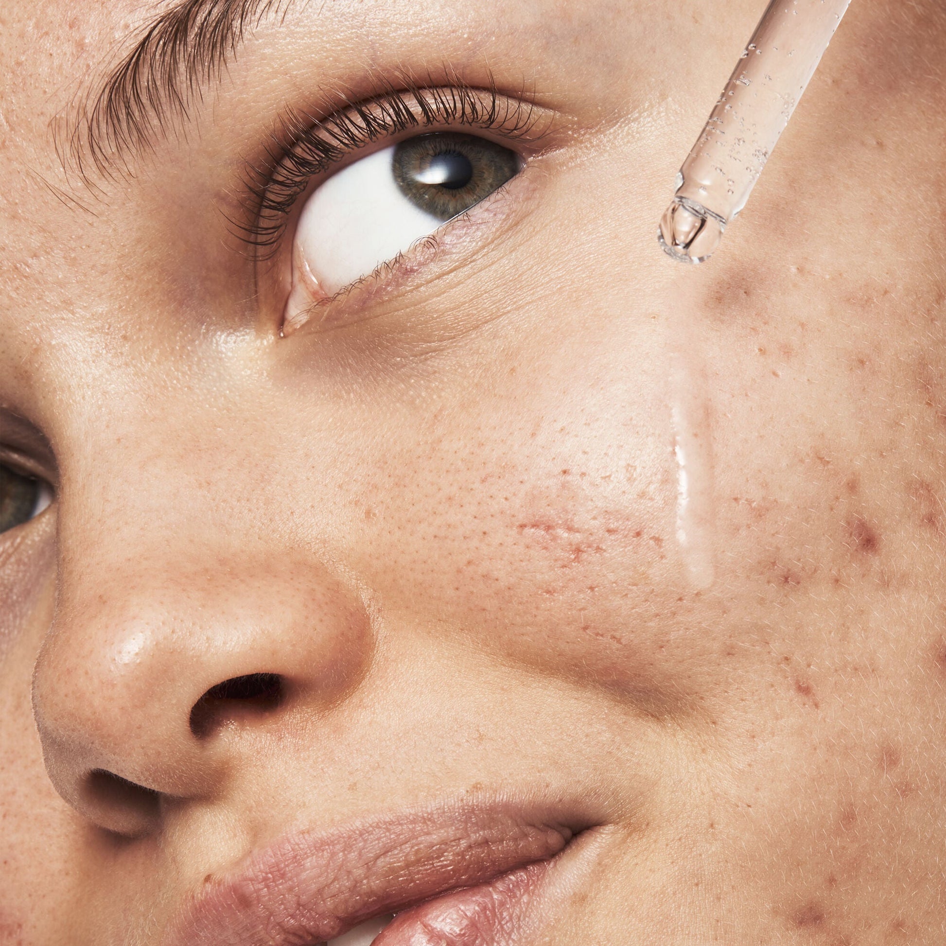 blemish-breakthrough-triple-acid-resurfacing-serum-s5 121321_Marley-Acne-Regimen_0254_FINAL_IGF.jpg