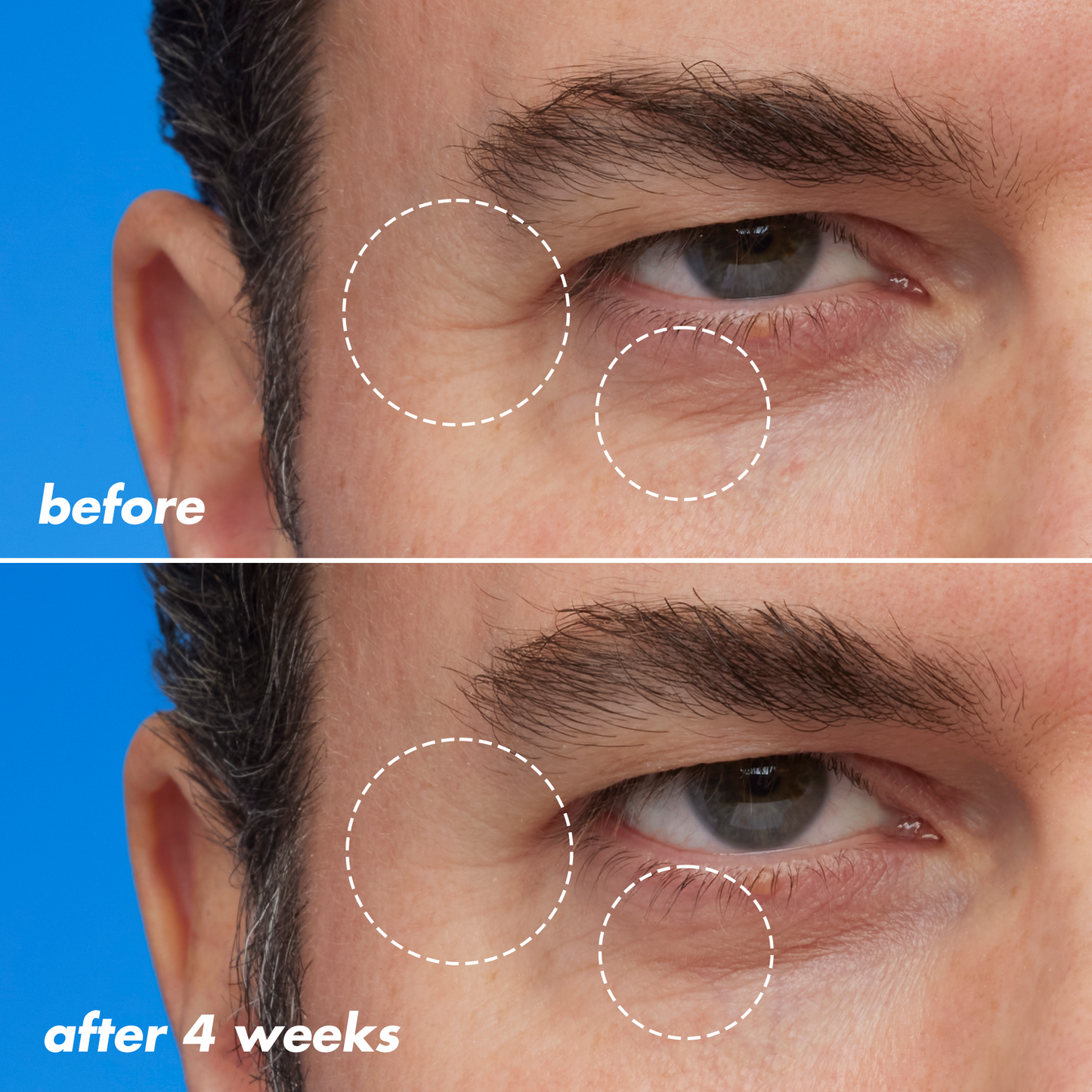 youth-boosting-blue-ty-sleep-night-oil-e0 EDU_Bluety_PDP_Paul.png