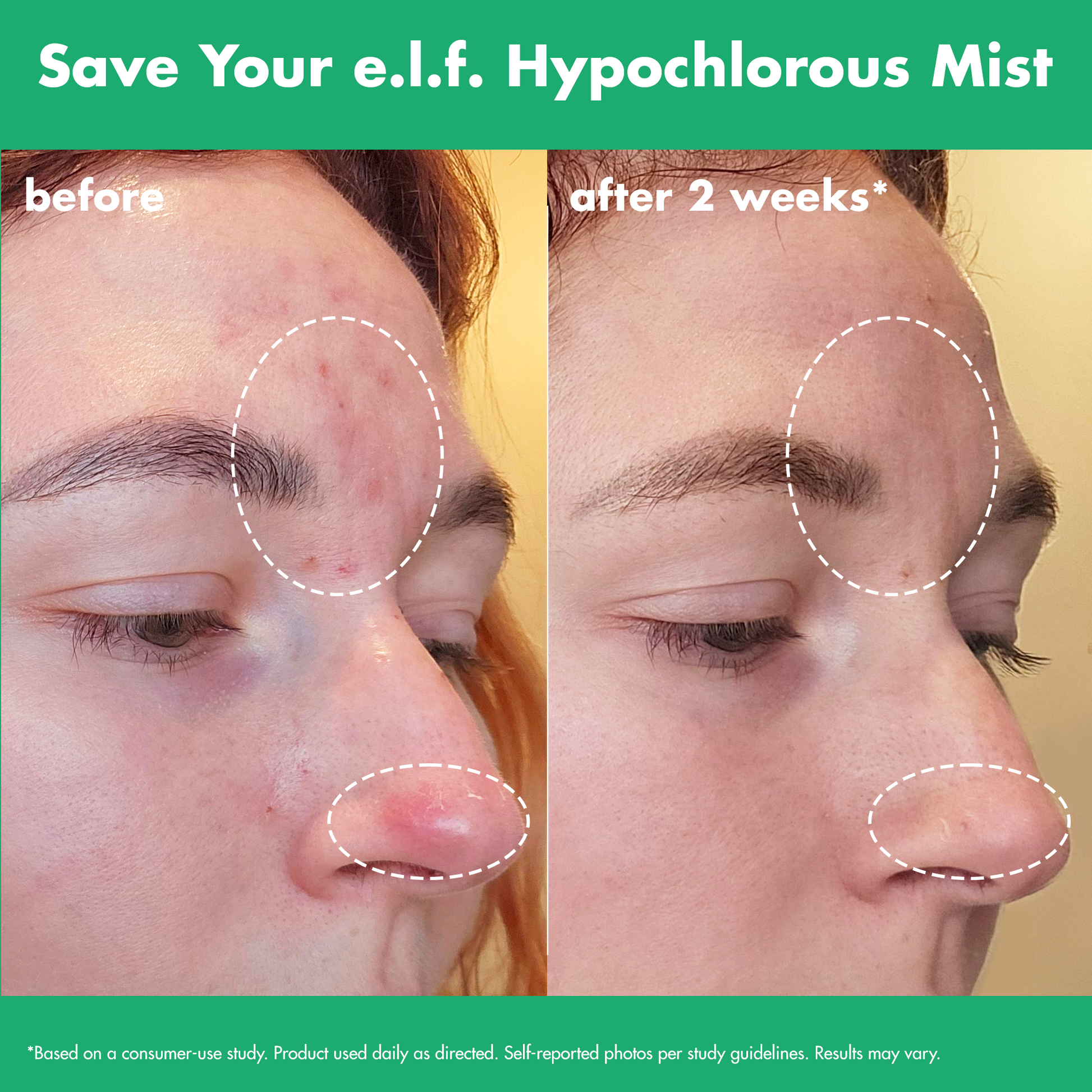 save-your-e-l-f-hypochlorous-mist-l5 FA26_EDUCATION_SAVEYOURELF_USAGE_BA1_WITHOUT_CLAIMS.png